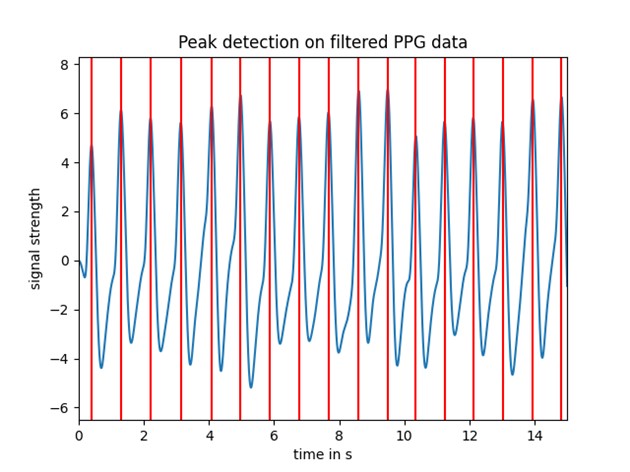 Vital Signs Data Processing